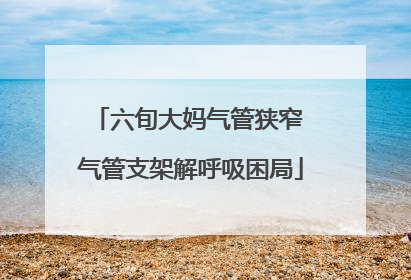 六旬大妈气管狭窄 气管支架解呼吸困局